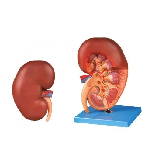 مولاژ کلیه