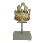 مولاژ فک و دندان - Image 2